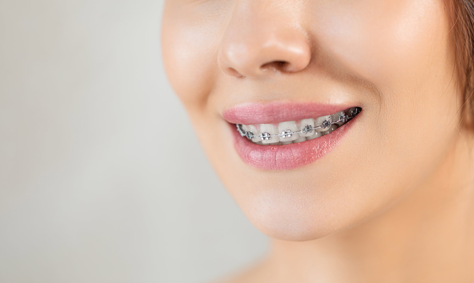 ortho1