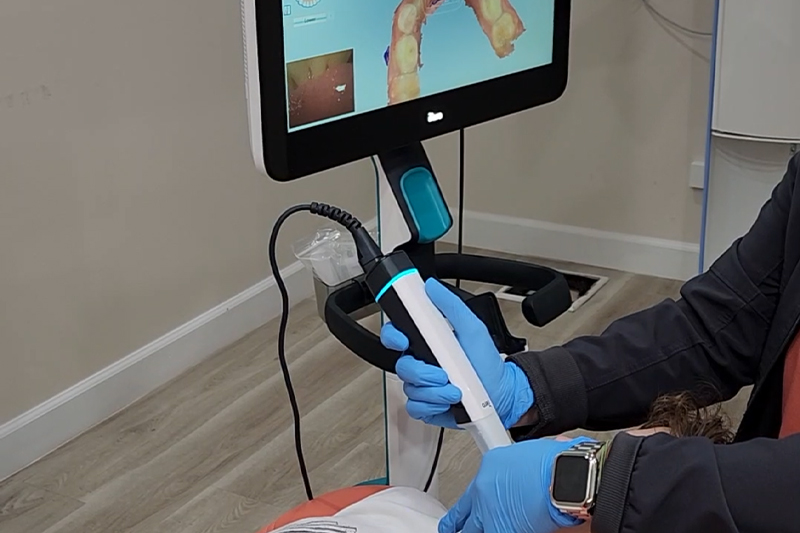 iTero Digital Scans in Wesley Chapel
